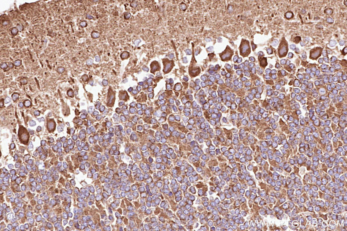 IHC staining of mouse cerebellum using 25326-1-AP IHC staining of mouse cerebellum using 25326-1-AP