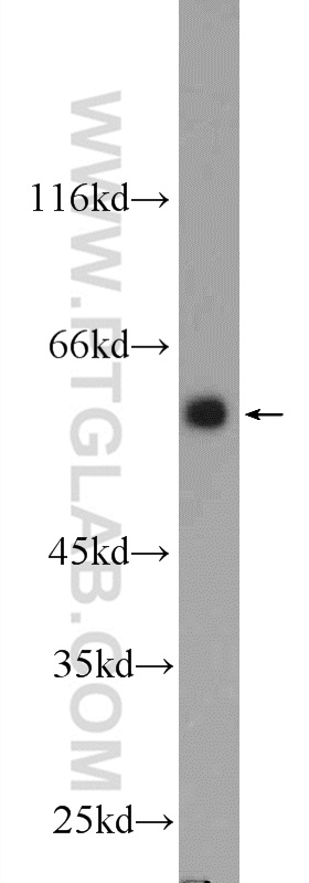 WB analysis of K-562 using 25326-1-AP