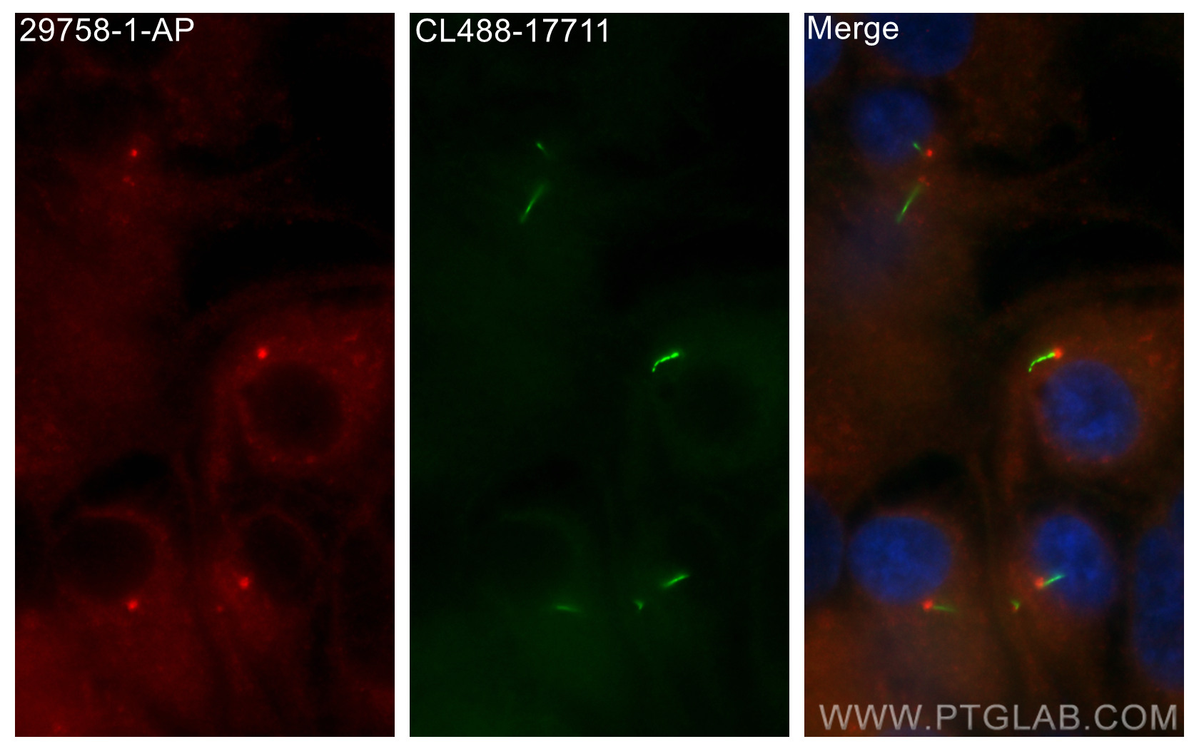 IF Staining of hTERT-RPE1 using 29758-1-AP