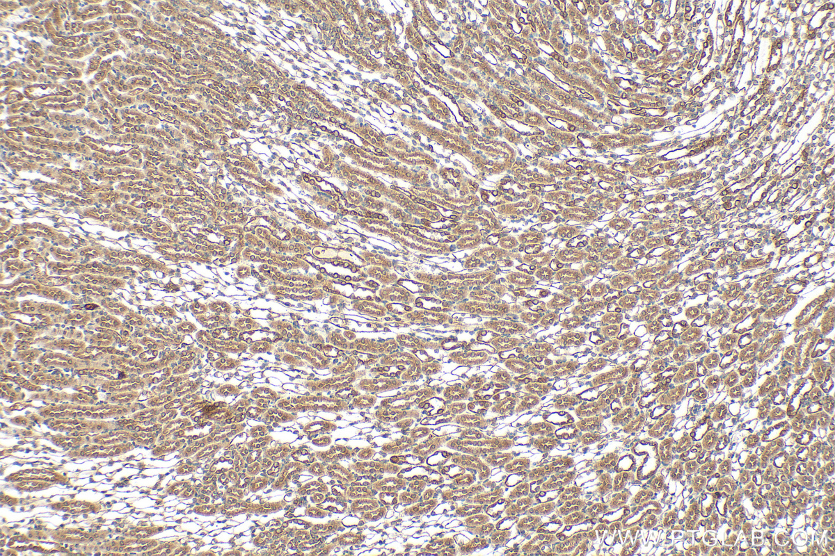 IHC staining of mouse kidney using 29758-1-AP