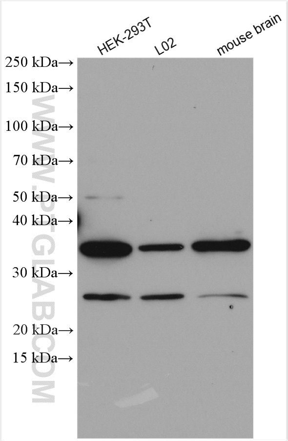 WB analysis using 15949-1-AP