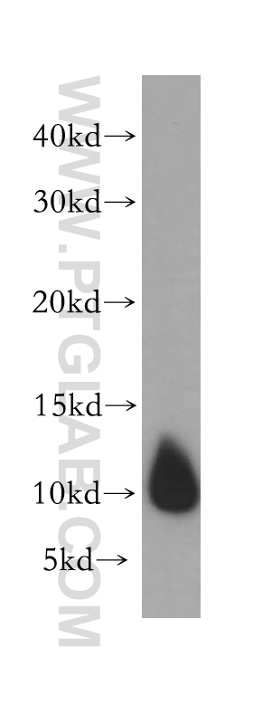 DYNLL2 Polyclonal antibody