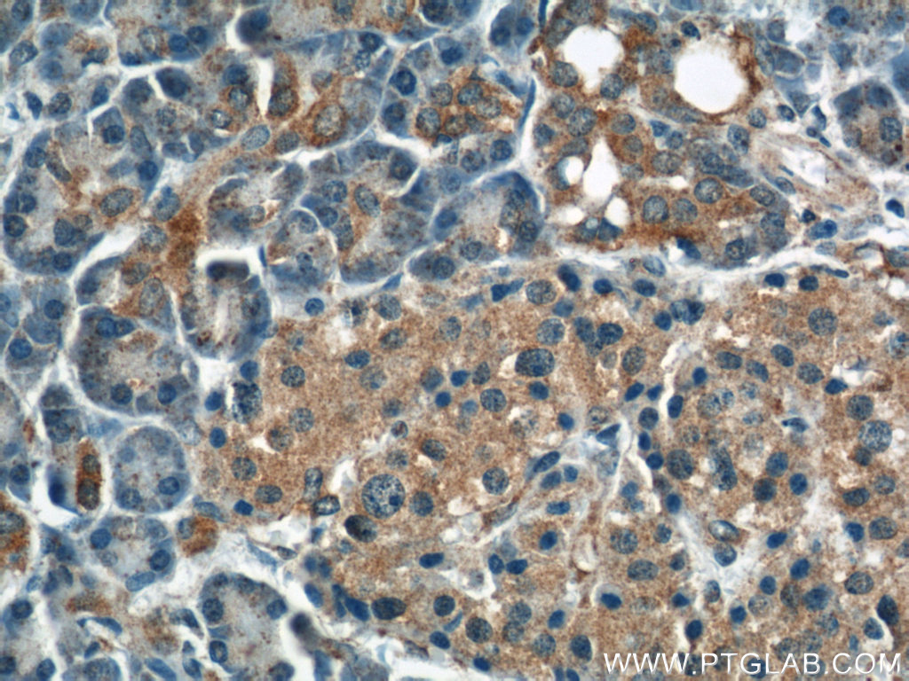 DYNLT1 Polyclonal antibody