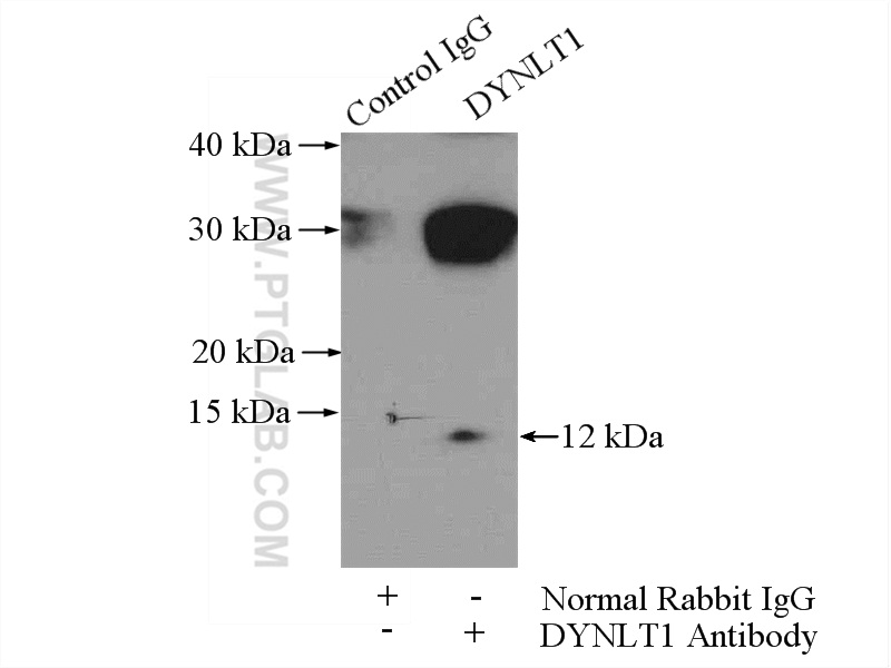 IP experiment of mouse skeletal muscle using 11954-1-AP