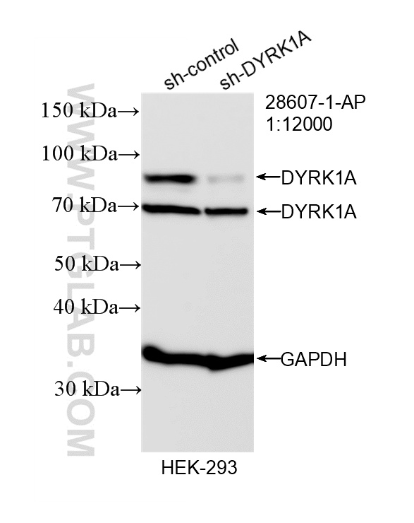 WB analysis of HEK-293 using 28607-1-AP WB analysis of HEK-293 using 28607-1-AP