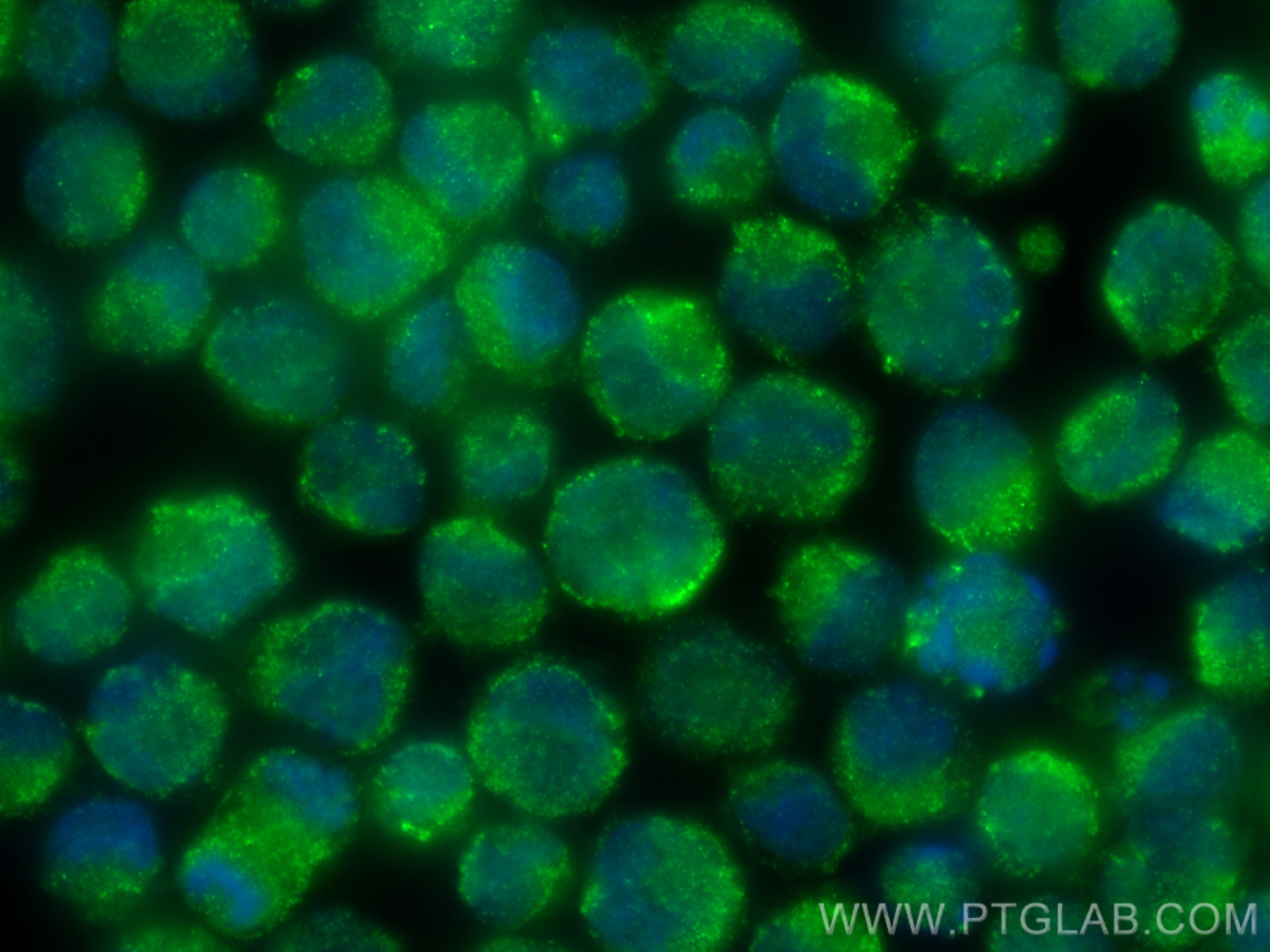 IF Staining of K-562 using 21979-1-AP