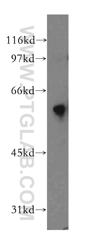 WB analysis of mouse lung using 12890-2-AP (same clone as 12890-2-PBS)