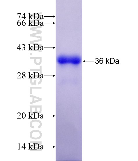 DYRK4 fusion protein Ag20395 SDS-PAGE