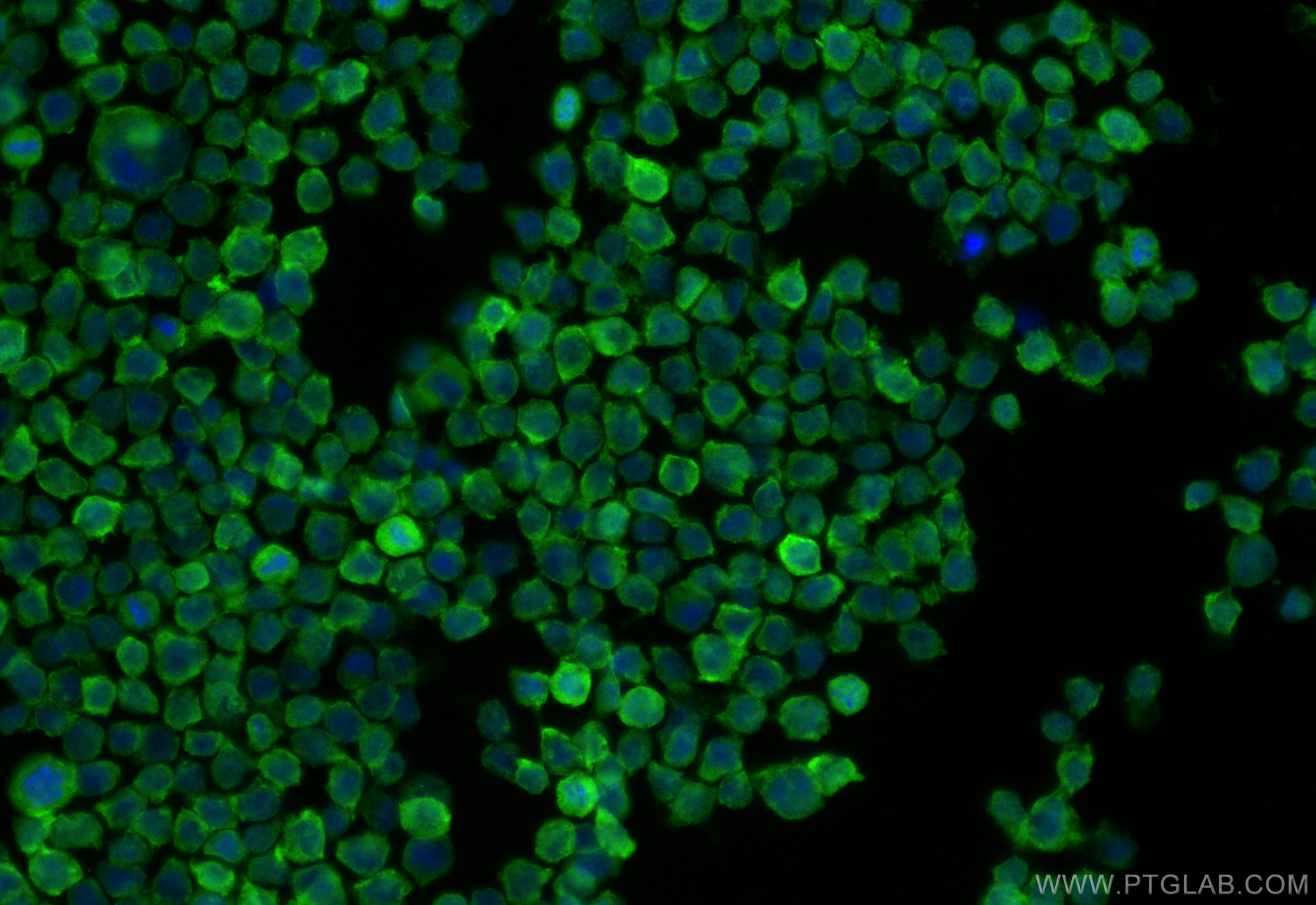 IF Staining of THP-1 using 18208-1-AP