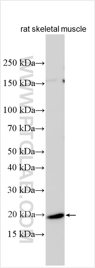 WB analysis using 18208-1-AP