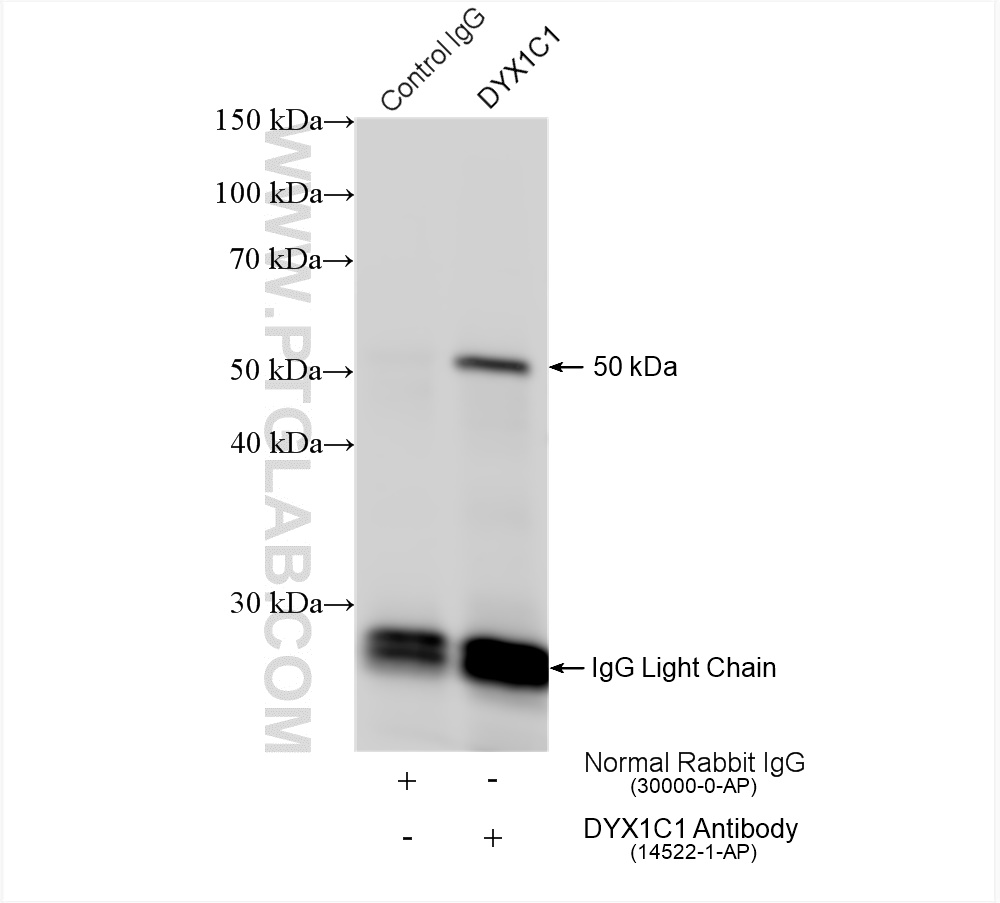 IP experiment of mouse testis using 14522-1-AP