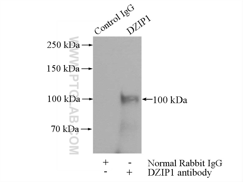 IP experiment of HEK-293 using 13779-1-AP