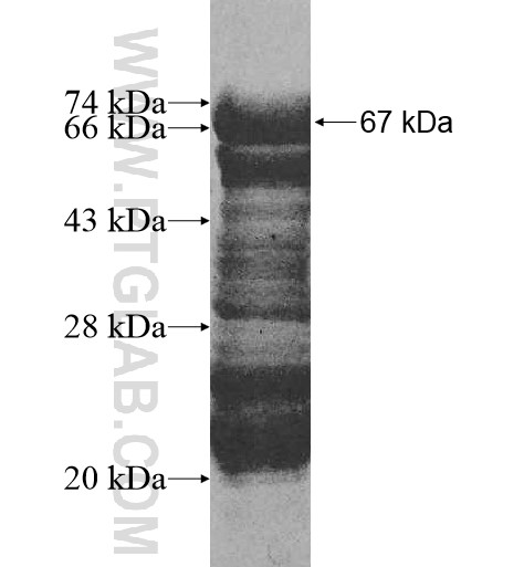 DZIP1L fusion protein Ag11034 SDS-PAGE
