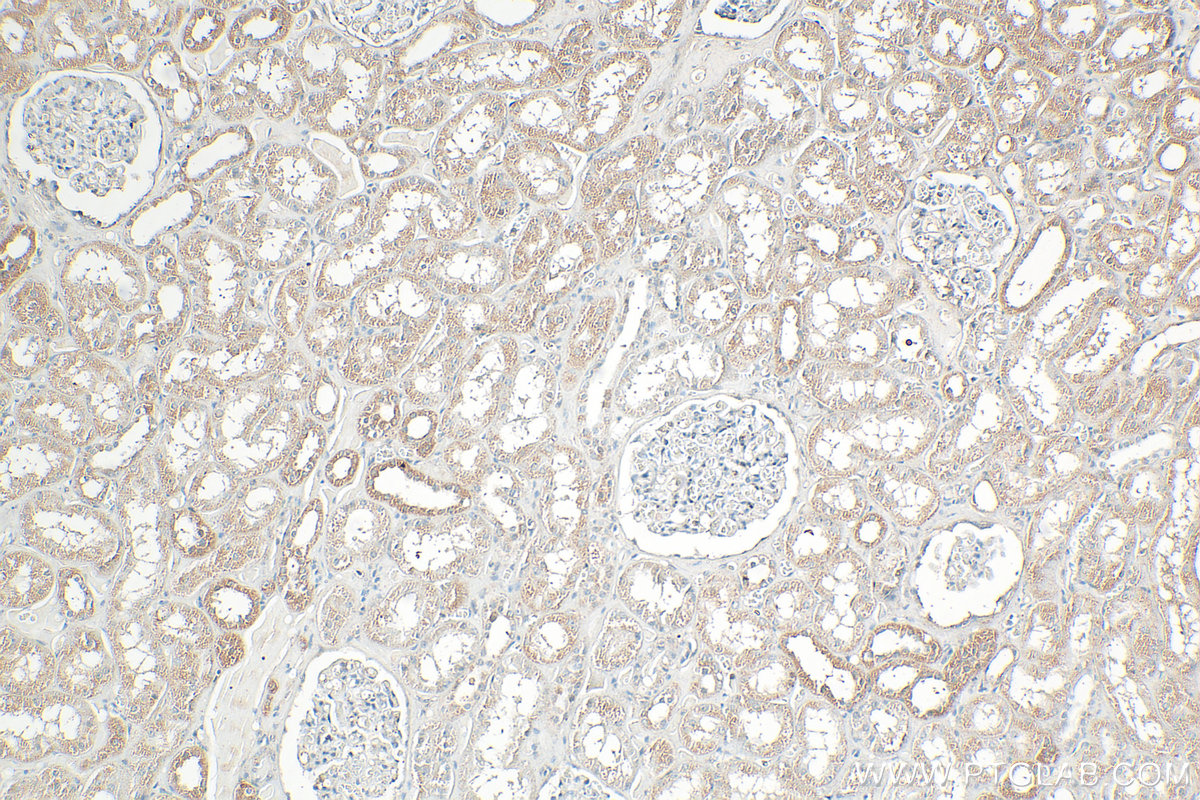 IHC staining of human kidney using 33563-1-AP