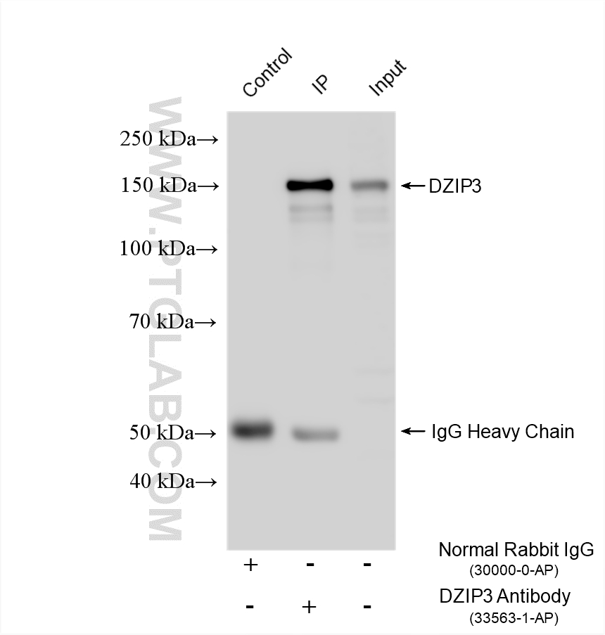 IP experiment of HEK-293T using 33563-1-AP