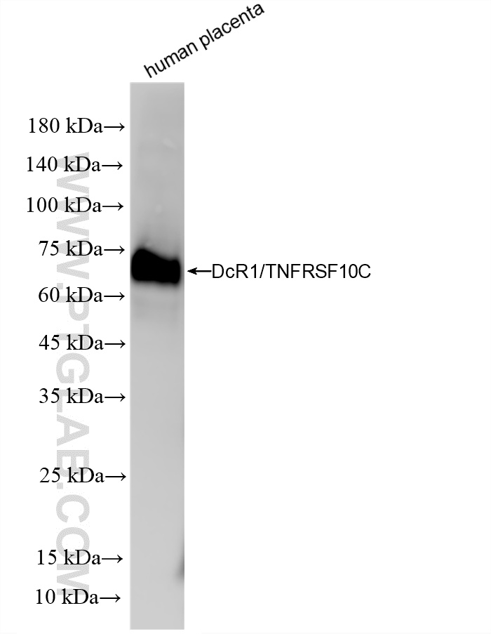 Human placenta tissue lysate was subjected to SDS PAGE followed by western blot with <a class='green' href='/productredirect?CatalogNo=86886-1-RR' target='_blank'>86886-1-RR</a> (DcR1/TNFRSF10C antibody) at dilution of 1:2000 incubated at room temperature for 1.5 hours. This data was developed using the same antibody clone with 86886-1-PBS in a different storage buffer formulation. WB analysis using 86886-1-RR (same clone as 86886-1-PBS)