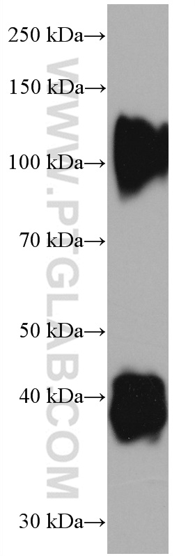 WB analysis of pig cartilage using 66847-1-Ig (same clone as 66847-1-PBS)