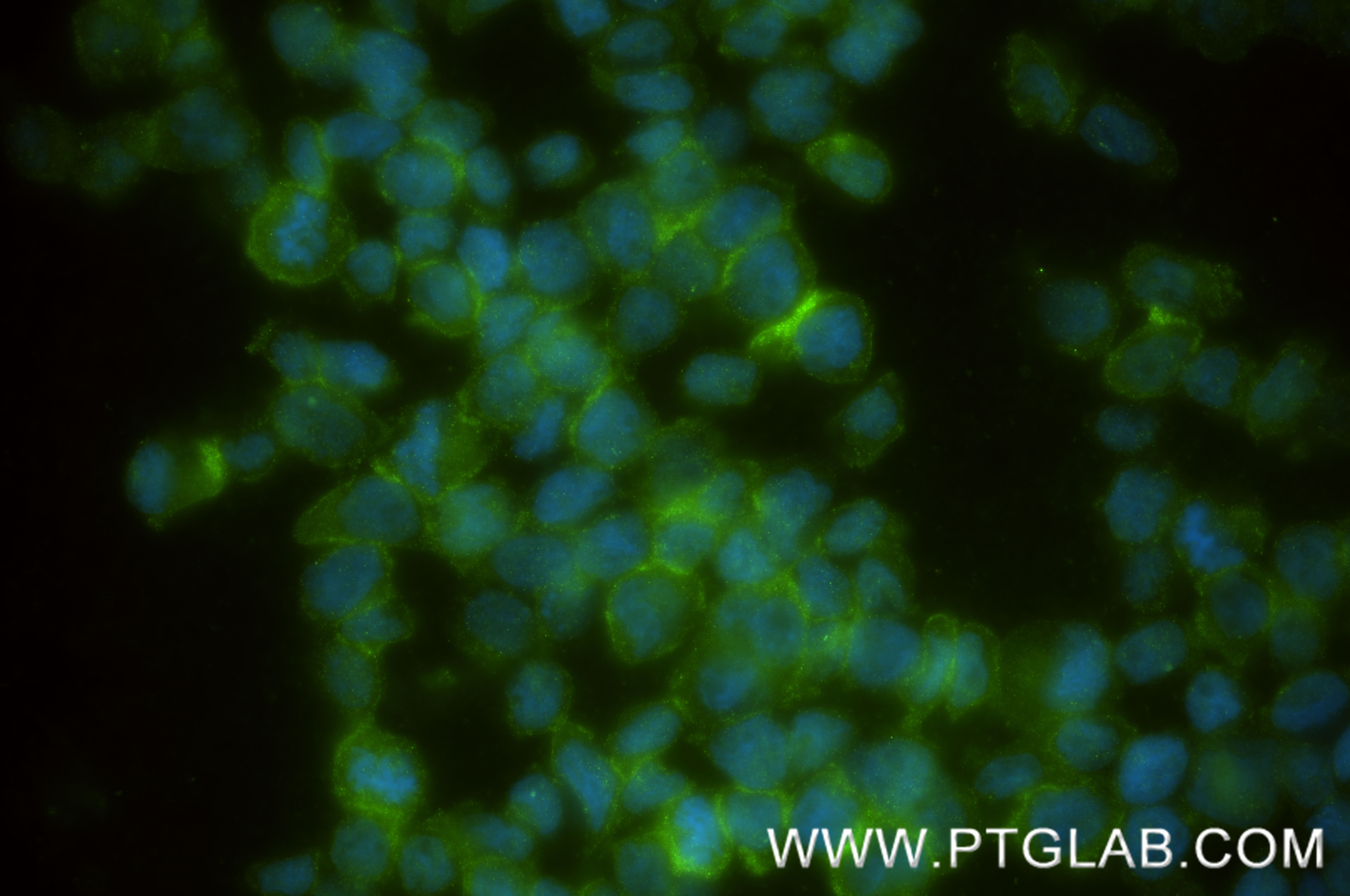 IF Staining of THP-1 using 83739-3-RR IF Staining of THP-1 using 83739-3-RR