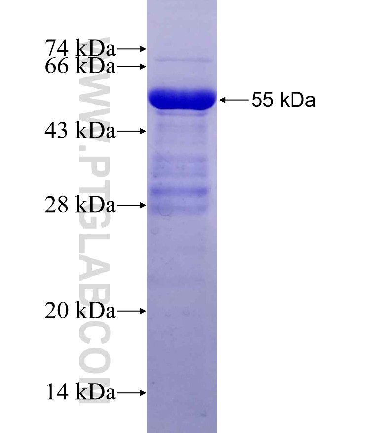 Dendrin fusion protein Ag29508 SDS-PAGE Dendrin fusion protein Ag29508 SDS-PAGE