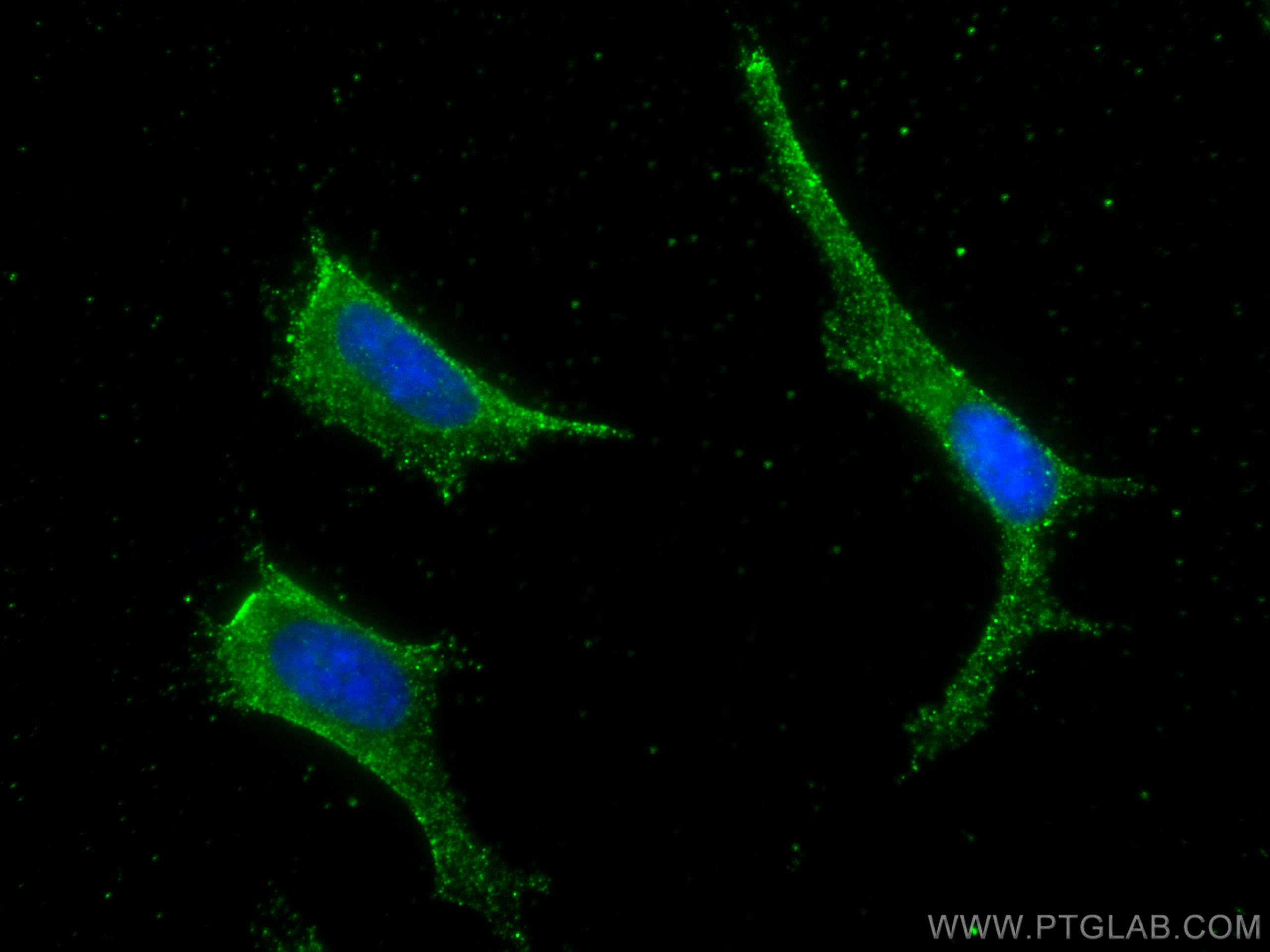 IF Staining of SH-SY5Y using 66348-1-Ig