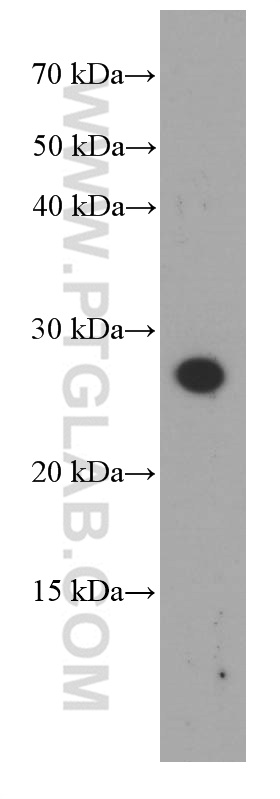 WB analysis of rat skin using 66348-1-Ig