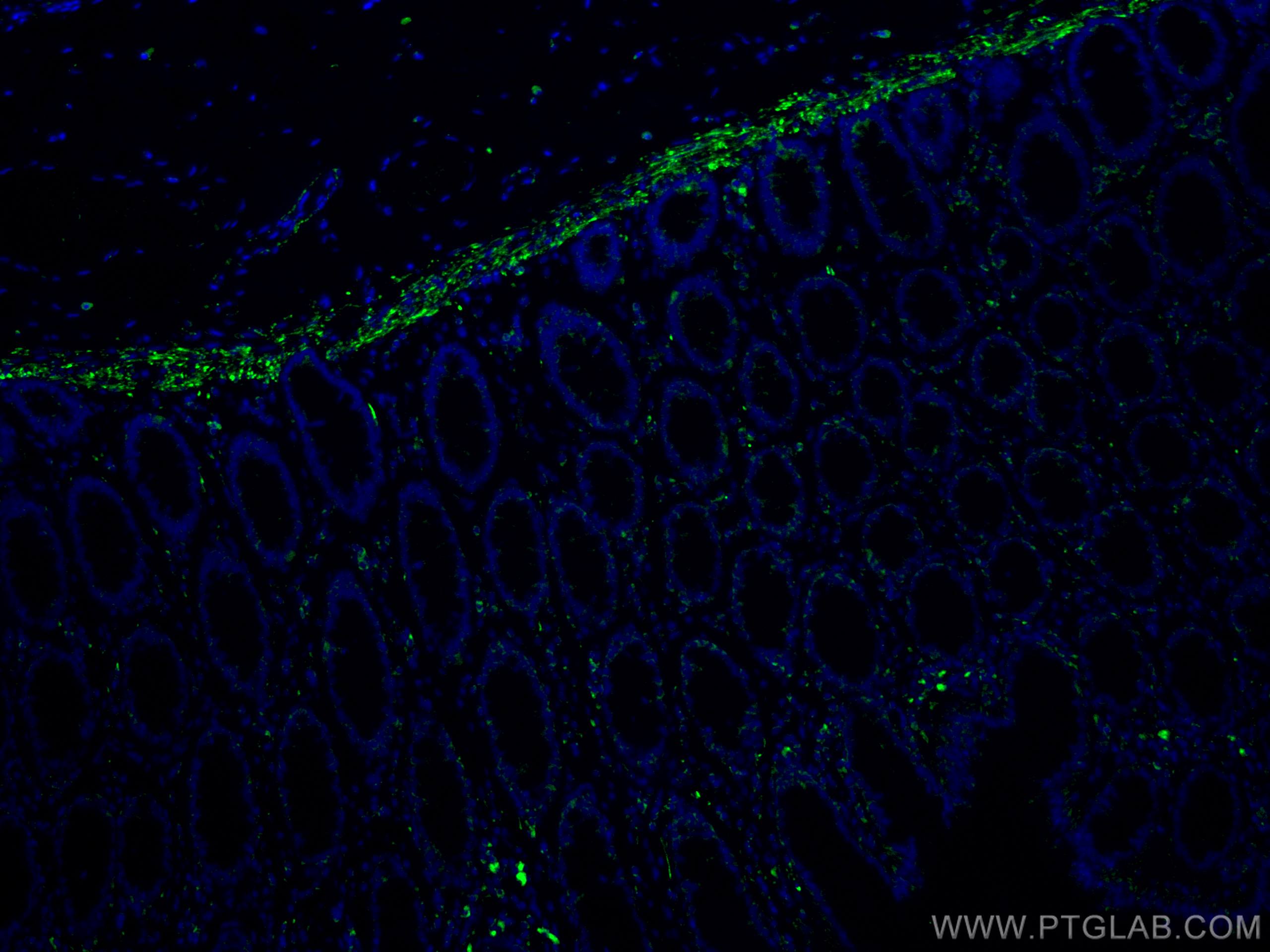 IF Staining of human colon using 67793-1-Ig (same clone as 67793-1-PBS)