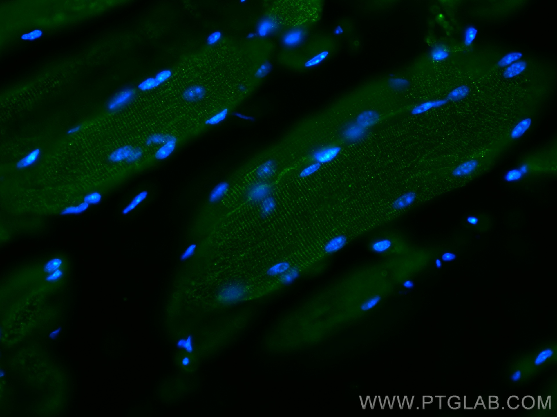 IF Staining of mouse skeletal muscle using 67793-1-Ig