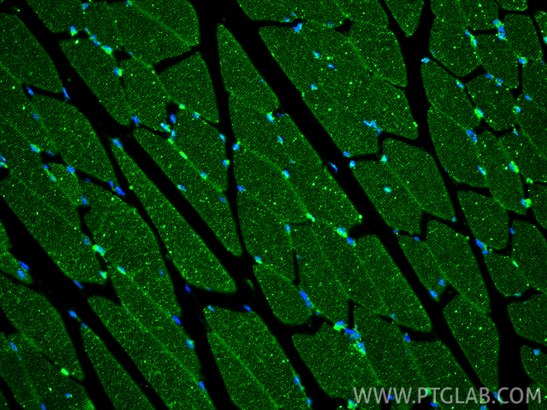 IF Staining of mouse skeletal muscle using 67793-1-Ig