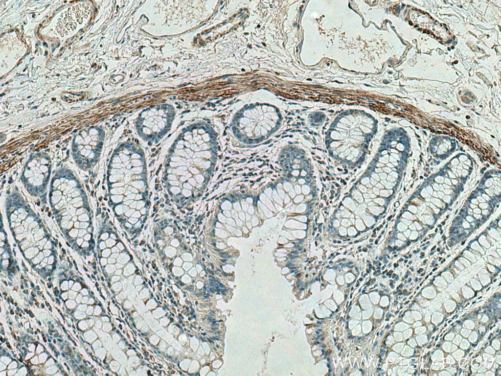 IHC staining of human colon using 67793-1-Ig (same clone as 67793-1-PBS)