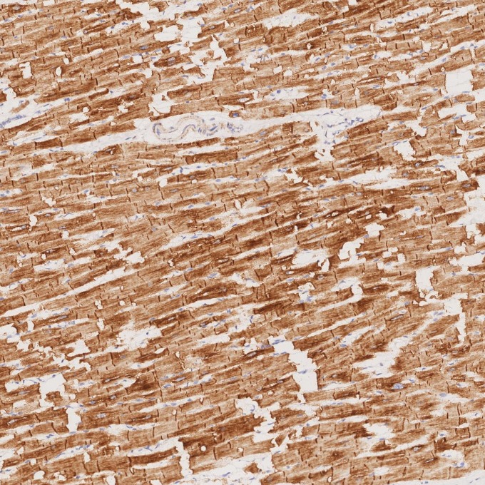 IHC staining of human heart using 67793-1-Ig IHC staining of human heart using 67793-1-Ig