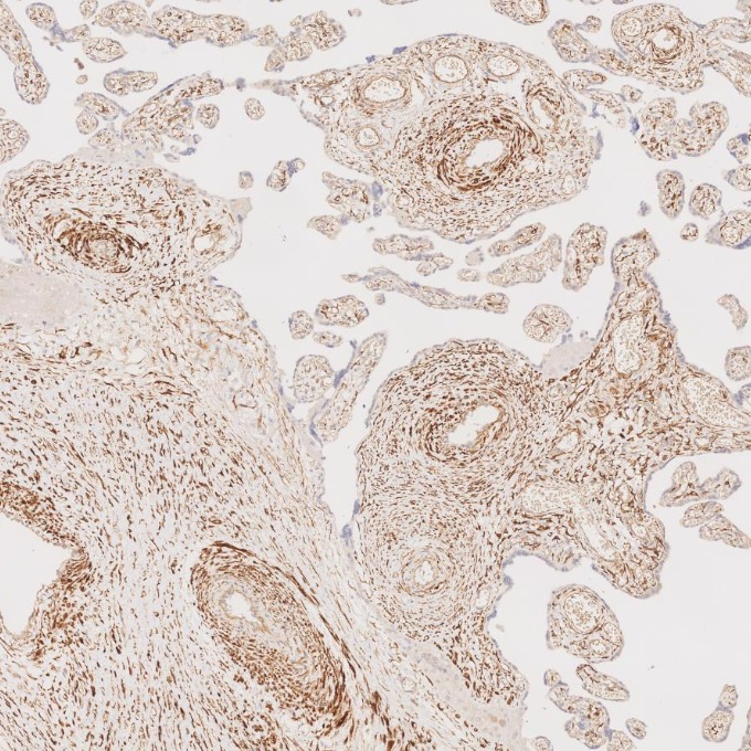 IHC staining of human placenta using 67793-1-Ig IHC staining of human placenta using 67793-1-Ig