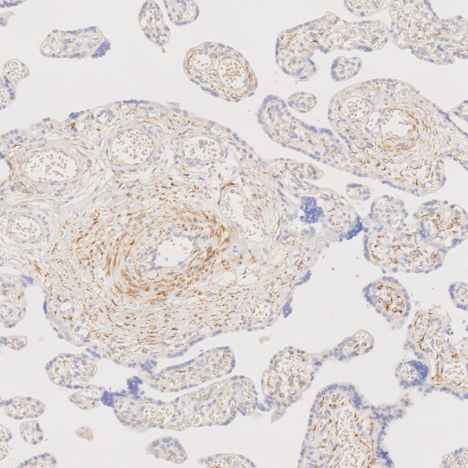 IHC staining of human placenta using 67793-1-Ig IHC staining of human placenta using 67793-1-Ig