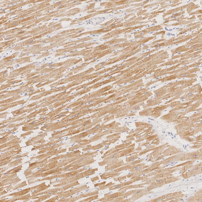 IHC staining of human heart using 67793-1-Ig IHC staining of human heart using 67793-1-Ig