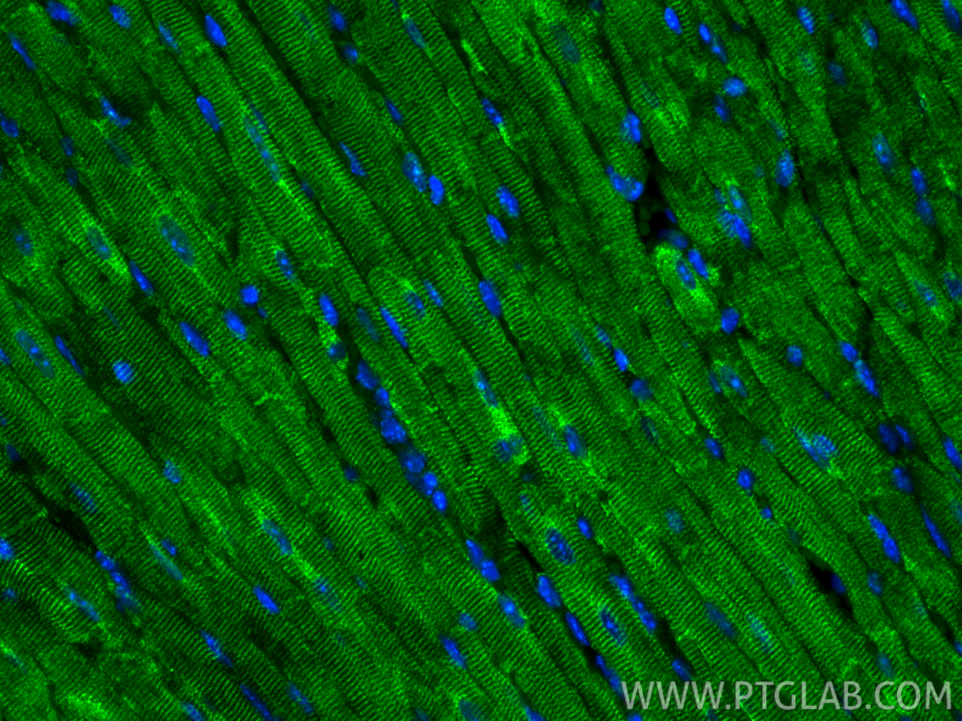 IF Staining of mouse heart using 82748-1-RR