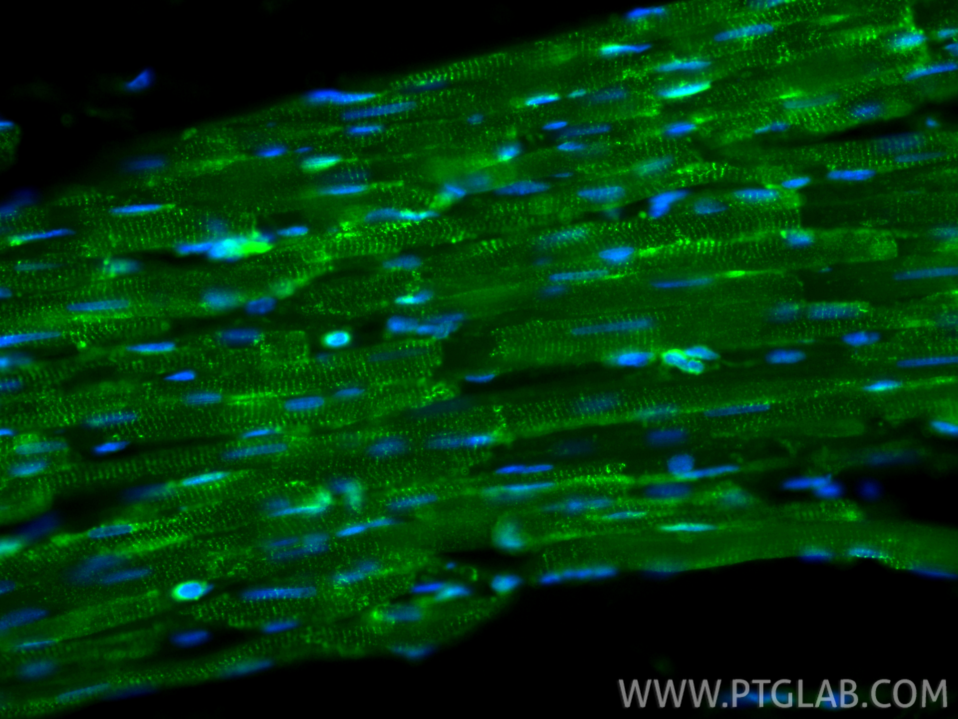 IF Staining of rat heart using 82748-1-RR
