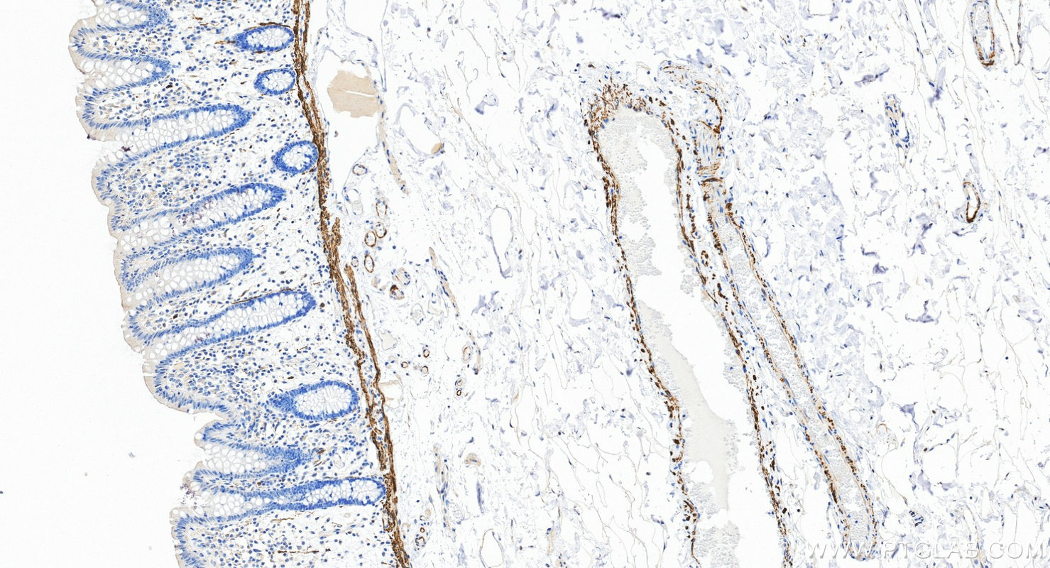 IHC staining of human colon using 82748-2-RR IHC staining of human colon using 82748-2-RR