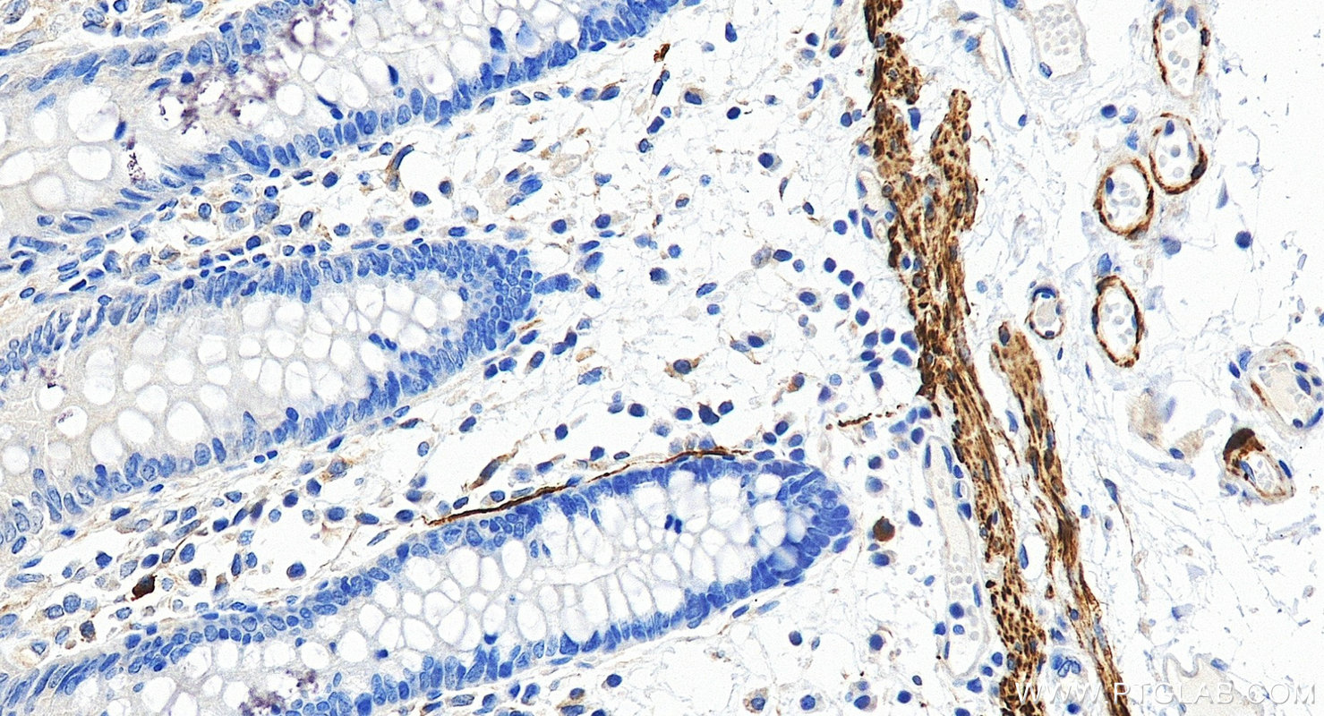 IHC staining of human colon using 82748-2-RR IHC staining of human colon using 82748-2-RR