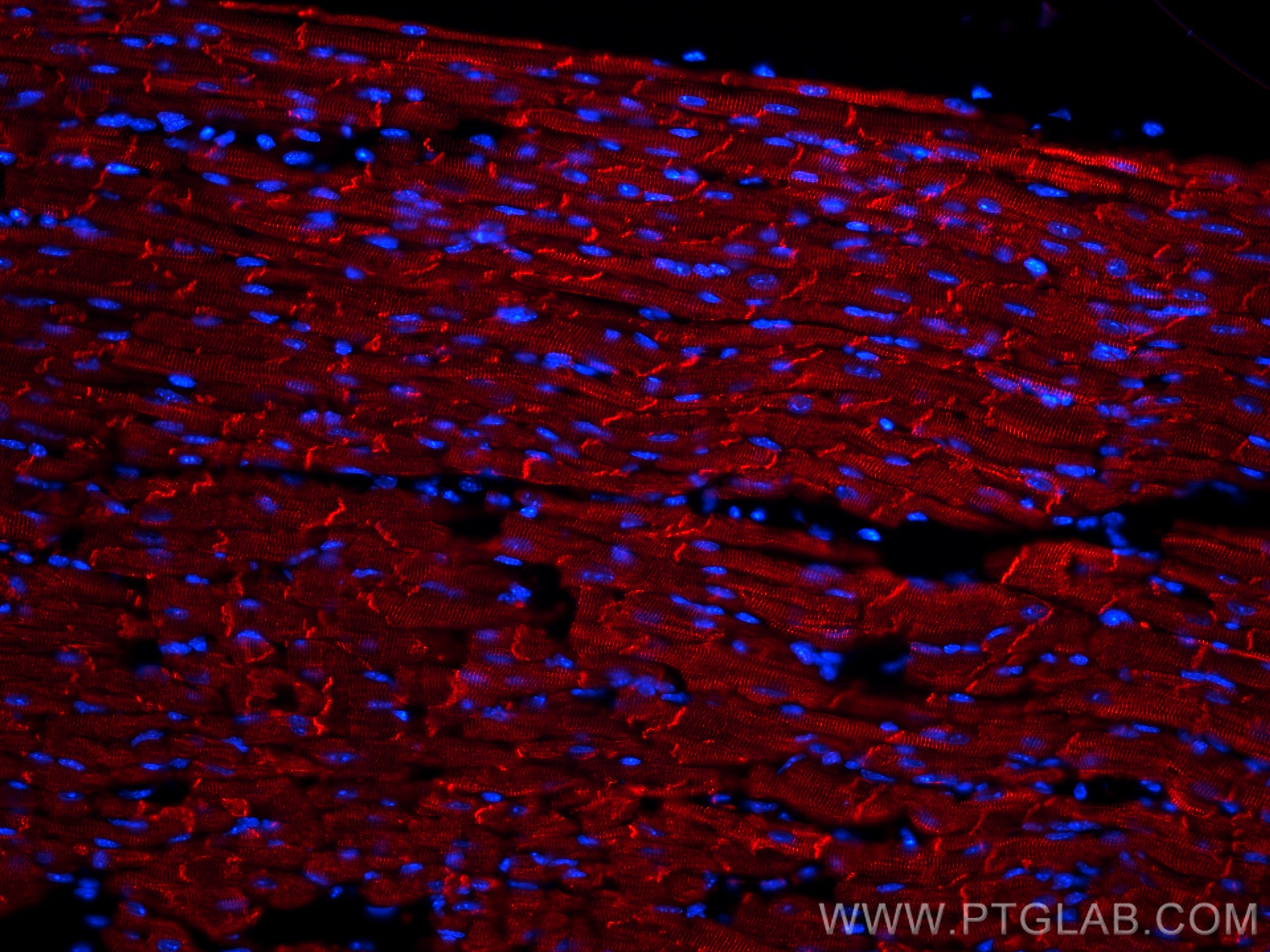 IF Staining of mouse heart using CL594-16520