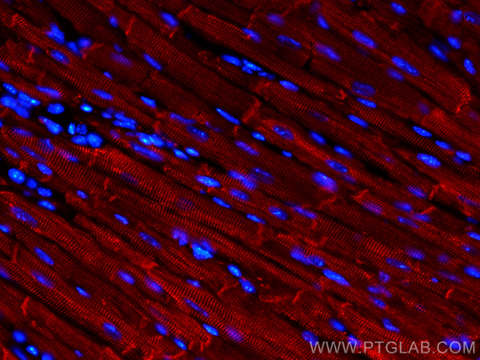 IF Staining of mouse heart using CL594-16520