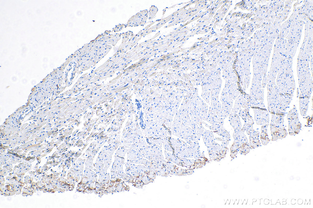 IHC staining of mouse heart using 25318-1-PBS