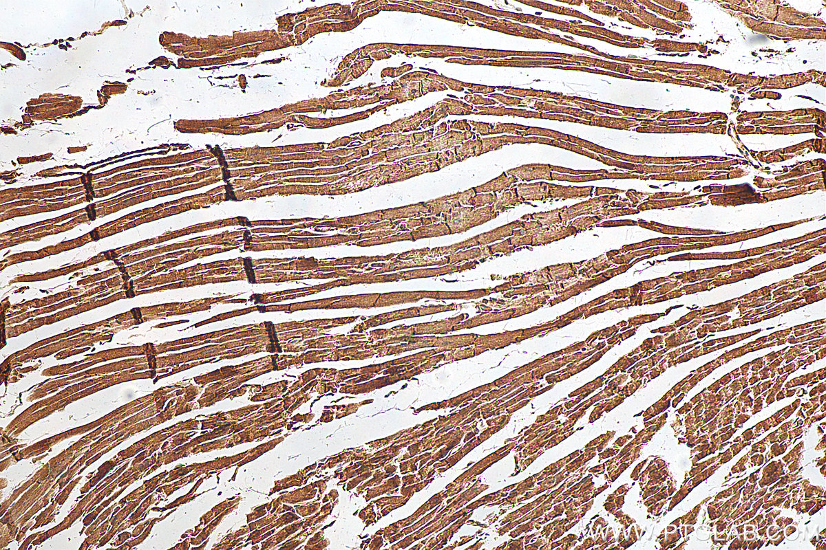 IHC staining of mouse heart using 25318-1-AP