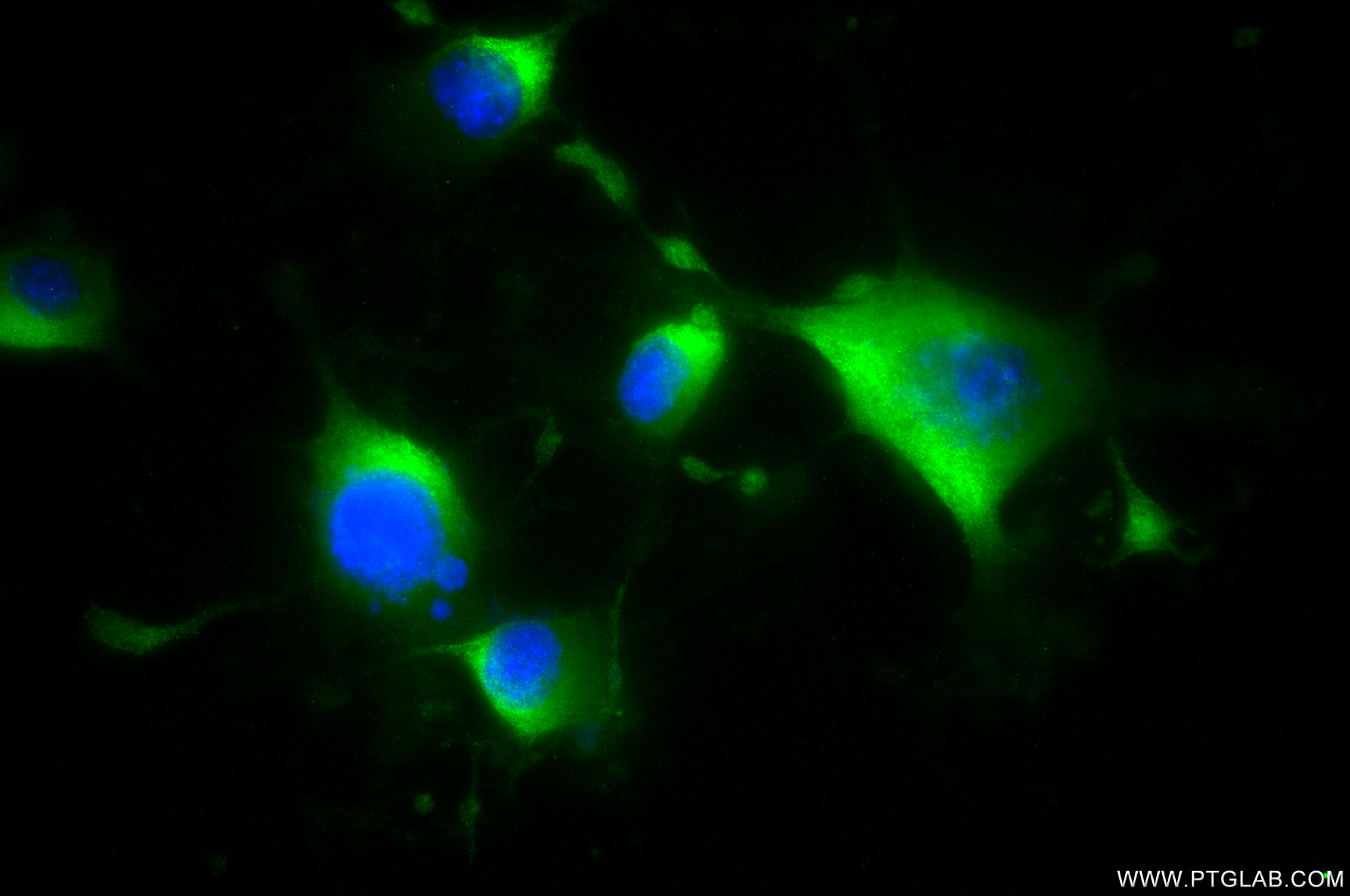 IF Staining of Neuro-2a using 82955-2-RR IF Staining of Neuro-2a using 82955-2-RR