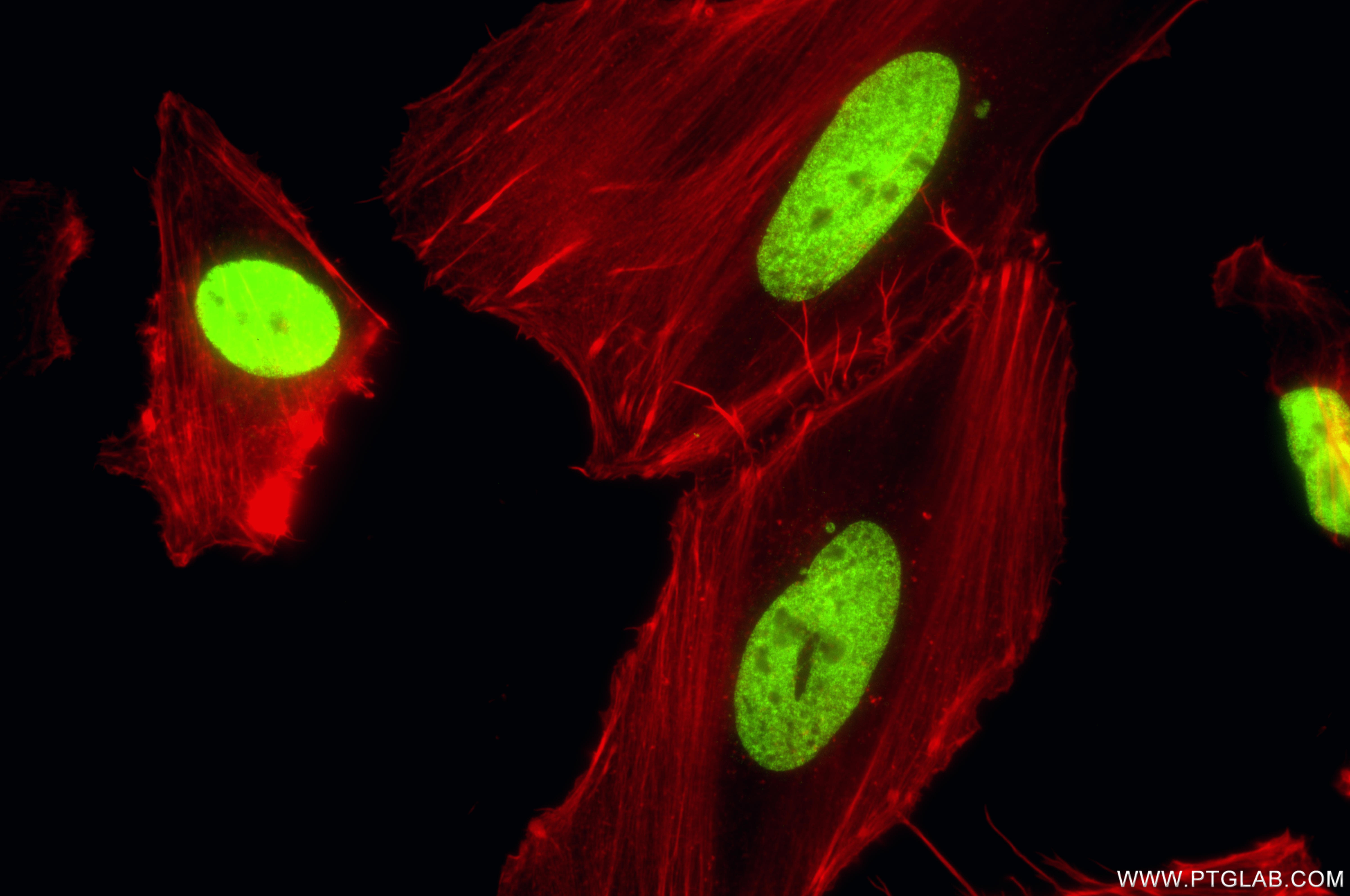 Immunofluorescent analysis of (4% PFA) fixed HeLa cells using Di-Methyl-Histone H3 (Lys27) antibody (<a class='green' href='/productredirect?CatalogNo=86890-2-RR' target='_blank'>86890-2-RR</a>, Clone: 251846E11 ) at dilution of 1:1000 and CoraLite®488-Conjugated Goat Anti-Rabbit IgG(H+L) (<a class='green' href='/productredirect?CatalogNo=SA00013-2' target='_blank'>SA00013-2</a>), CL594-Phalloidin (red). This data was developed using the same antibody clone with 86890-2-PBS in a different storage buffer formulation. IF Staining of HeLa using 86890-2-RR (same clone as 86890-2-PBS)