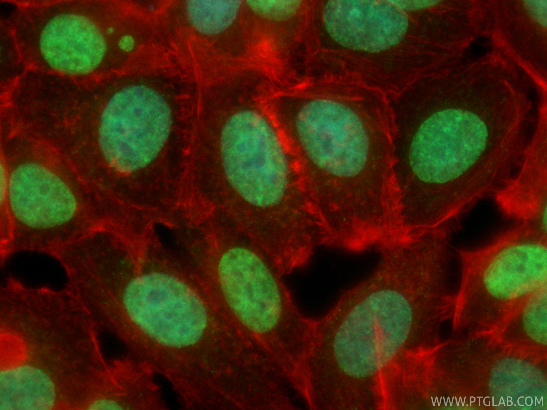 IF Staining of MCF-7 using CL488-86890-2 IF Staining of MCF-7 using CL488-86890-2