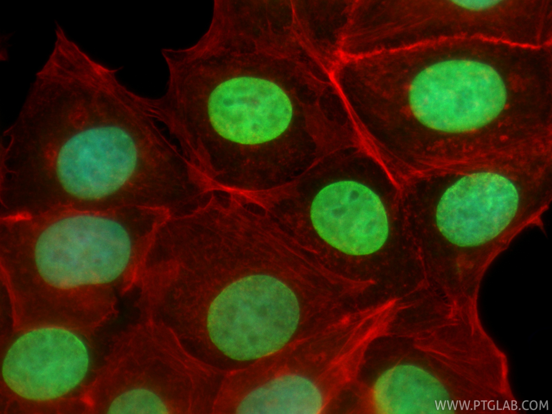 IF Staining of MCF-7 using CL488-86990-2 IF Staining of MCF-7 using CL488-86990-2