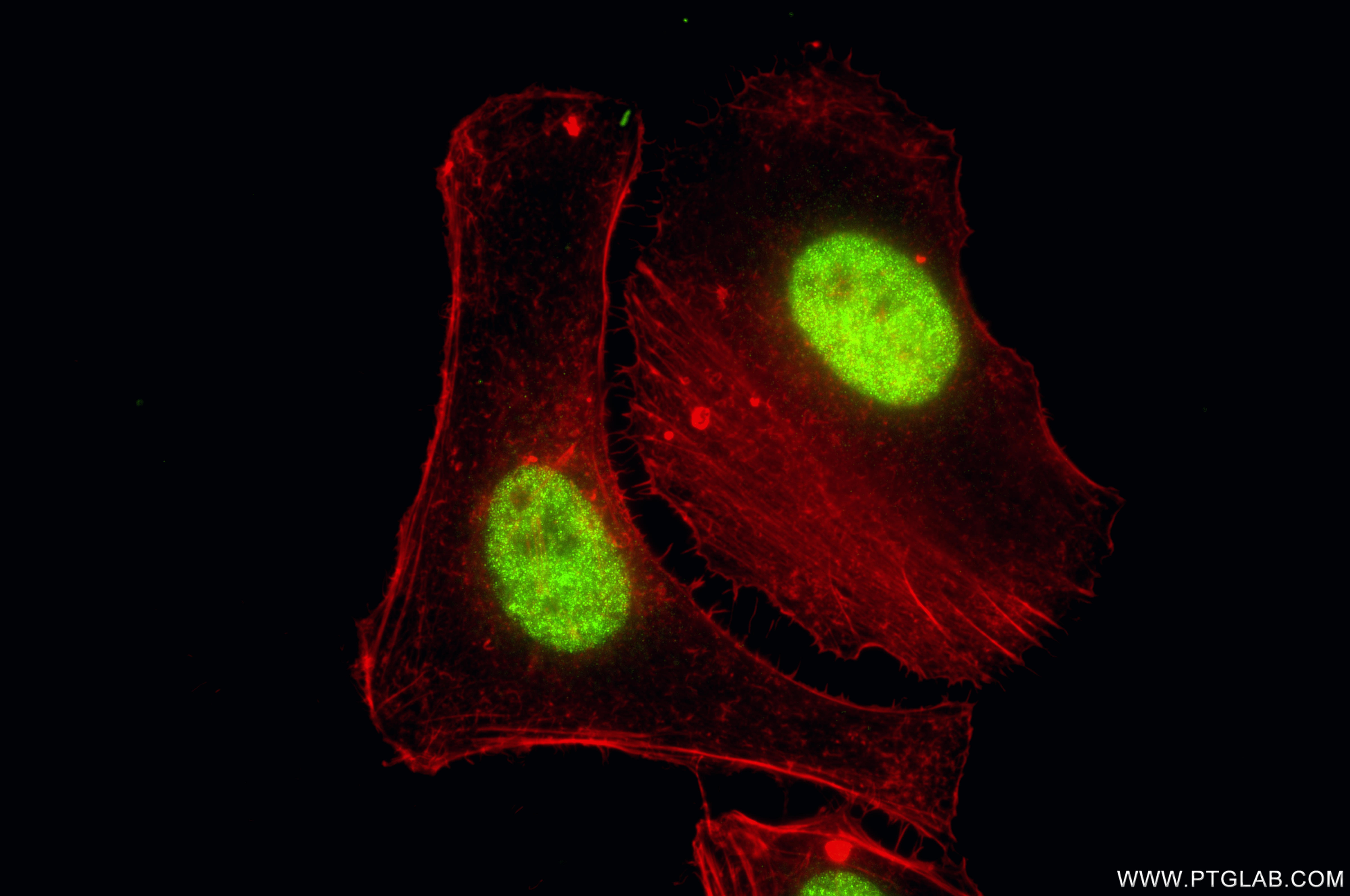 Immunofluorescent analysis of (4% PFA) fixed HeLa cells using Di-Methyl-Histone H4 (Lys20) antibody (87006-1-RR, Clone: 251934G9 ) at dilution of 1:1000 and CoraLite®488-Conjugated Goat Anti-Rabbit IgG(H+L) (<a class='green' href='/productredirect?CatalogNo=SA00013-2' target='_blank'>SA00013-2</a>), CL594-Phalloidin (red). IF Staining of HeLa using 87006-1-RR