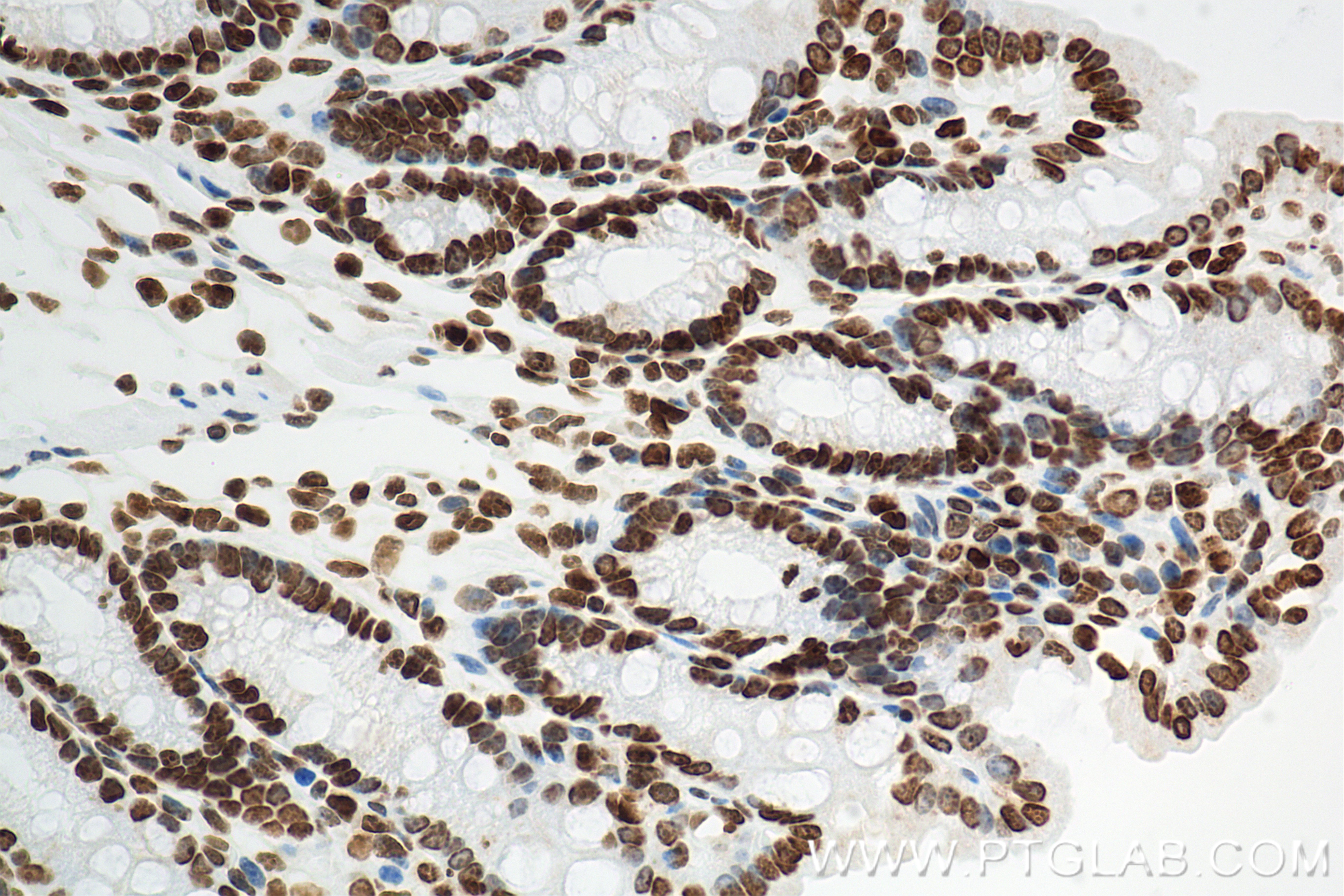 Immunohistochemical analysis of paraffin-embedded mouse colon tissue slide using 87006-1-RR (Di-Methyl-Histone H4 (Lys20) antibody) at dilution of 1:1000 (under 40x lens). Heat mediated antigen retrieval with Tris-EDTA buffer (pH 9.0). IHC staining of mouse colon using 87006-1-RR