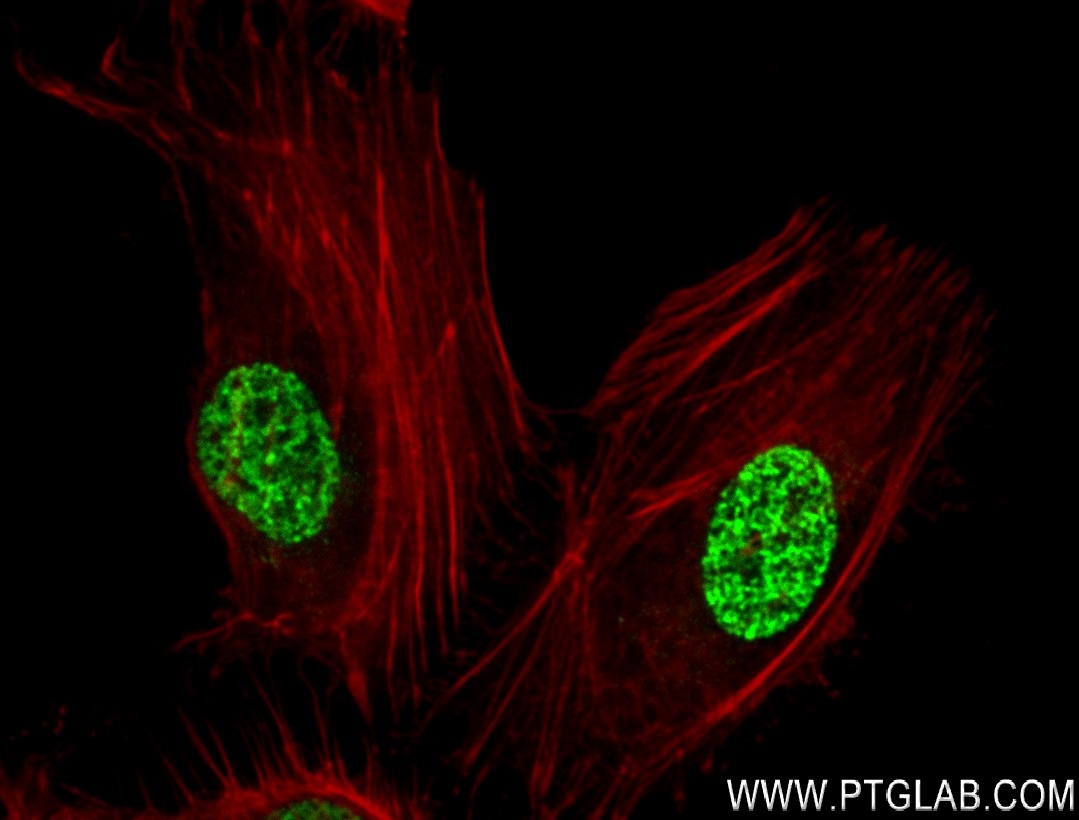 IF Staining of HeLa using 84329-1-RR