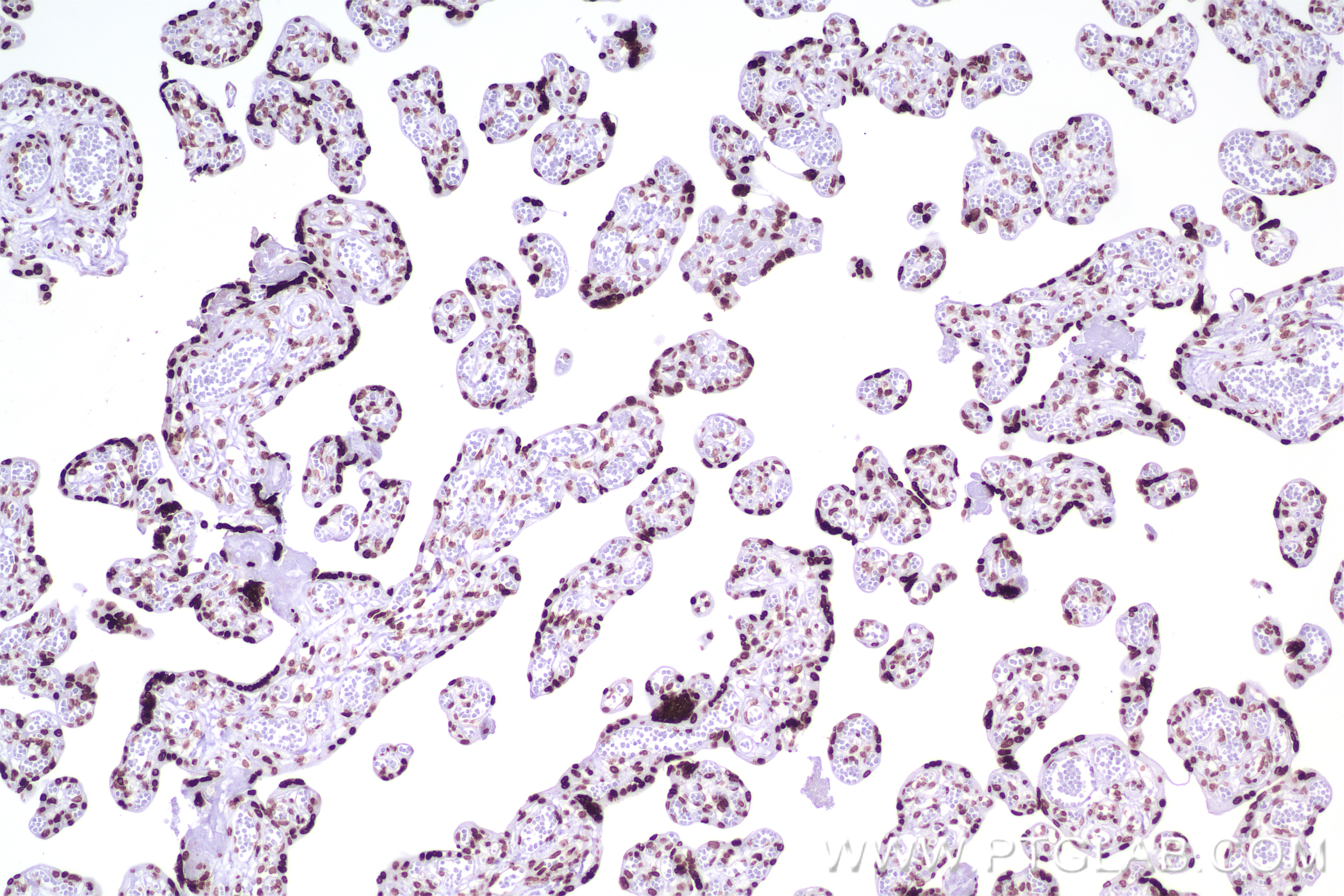 IHC staining of human placenta using 84329-1-RR