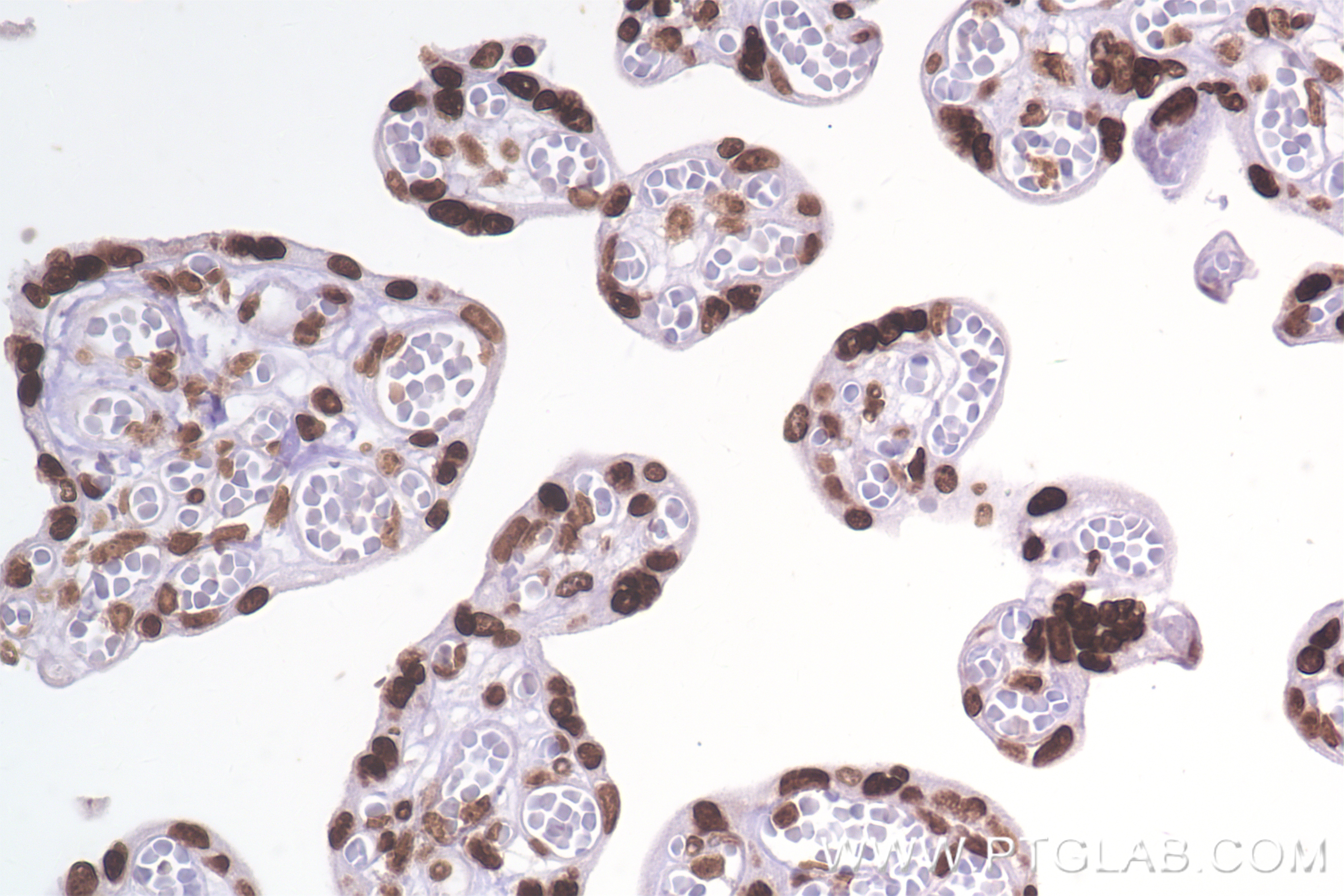 IHC staining of human placenta using 84329-1-RR